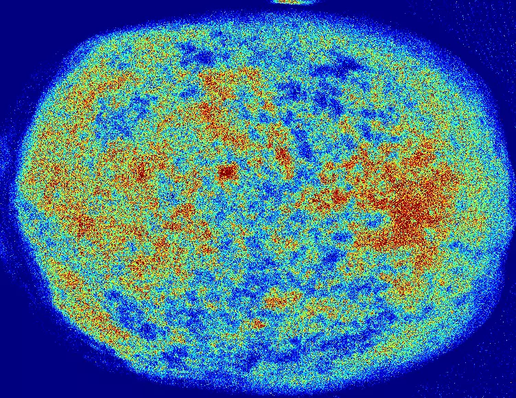 Eine kreisförmige Heatmap von einem Kopf mit lebendigen Rot-, Gelb- und Blautönen zeigt Intensitätsvariationen der Mikro-Durchblutung vor einem dunkelblauen Hintergrund.