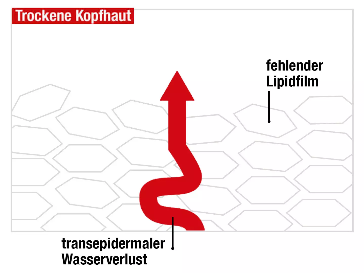 Ein roter Pfeil durchbricht eine Fläche von Sechsecken, die die Hautbarriere darstellen sollen. Die Grafik veranschaulicht den transepidermalen Wasserverlust aufgrund des gestörten Lipidfilms bei trockener Kopfhaut.