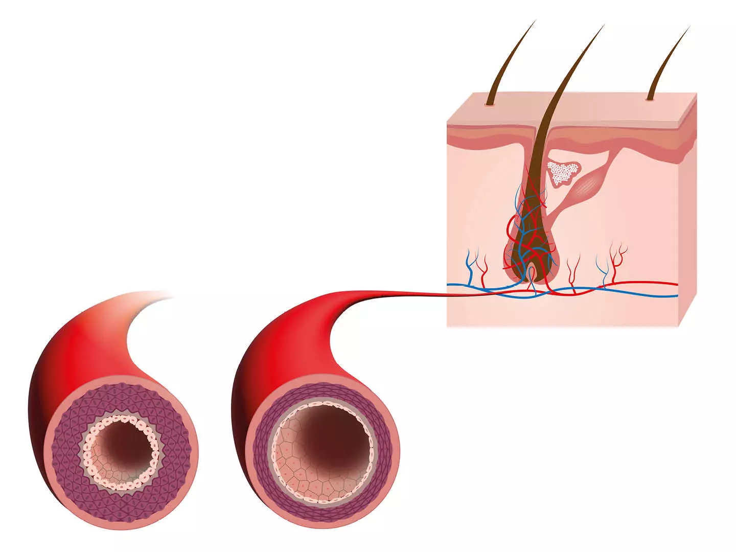 Schematische Darstellung der Gefäßerweiterung der kleinsten Blutgefäße der Haarwurzel als Sinnbild für die Wirkung von DMG gegen erblich bedingten Haarausfall bei Männern