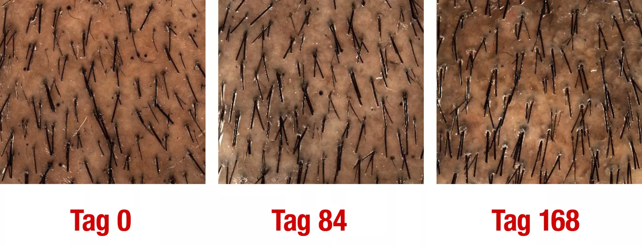Drei Nahaufnahmen von Haut zeigen das Haarwachstum in Intervallen: "Tag 0," "Tag 84," und "Tag 168." Jedes Bild zeigt unterschiedliche Haardichte auf einer ähnlichen Hautoberfläche.