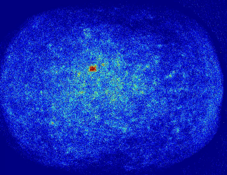 Eine kreisförmige Heatmap von einem Kopf, überwiegend in Blau, mit einem kleinen zentralen gelben und roten Bereich, zeigt Intensitätsvariationen der Mikro-Durchblutung vor einem dunkelblauen Hintergrund.